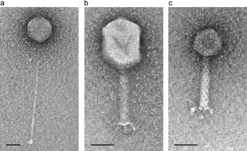 Transmission electron microscopy showing T shaped phage bacteriophages